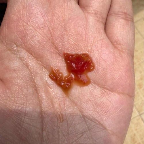 ลักษณะนี้คืออะไรคะ