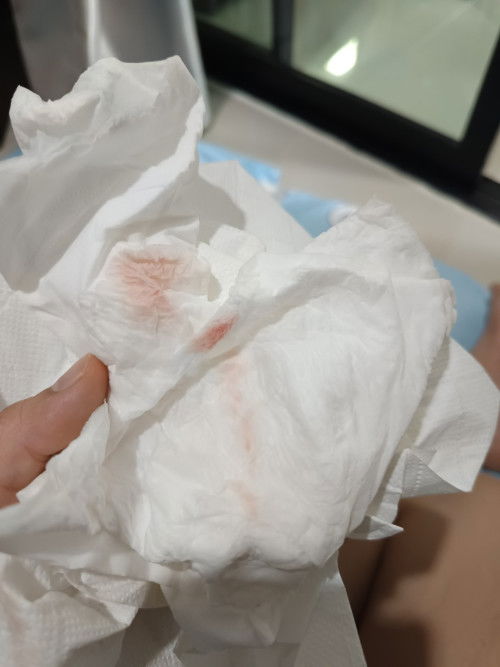 เลือด+ตกขาวขณะตั้งครรภ์