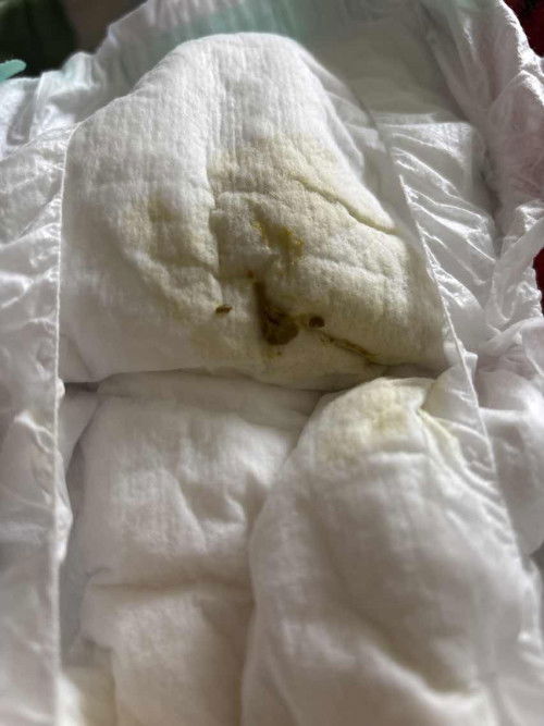 แบบนี้ปกติมั้ยคะ