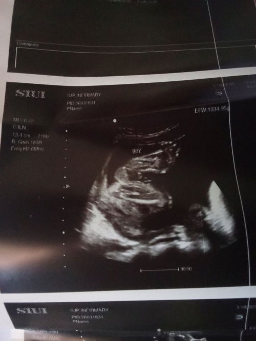 Paki explain po saakin kung pano po nasabi yung gender?