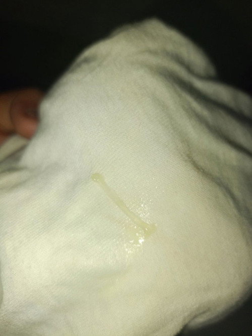 Ano po kaya itong lumabas sakin?