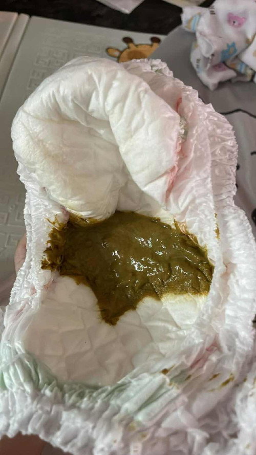 แบบนี้ปกติมั้ยคะกลิ่นค่อนข้างเหมือนอึผู้ใหญ่