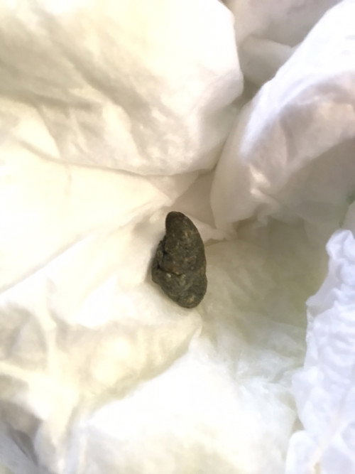 หลังลูกกินยา เกี่ยวกับลำไส้ค่ะ