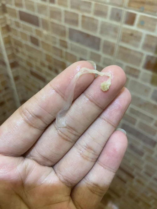 เด็ก31สัปดาห์