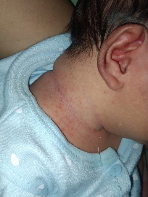 Bintik merah di leher