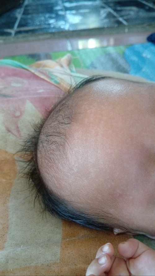 Biang keringet atau apa?