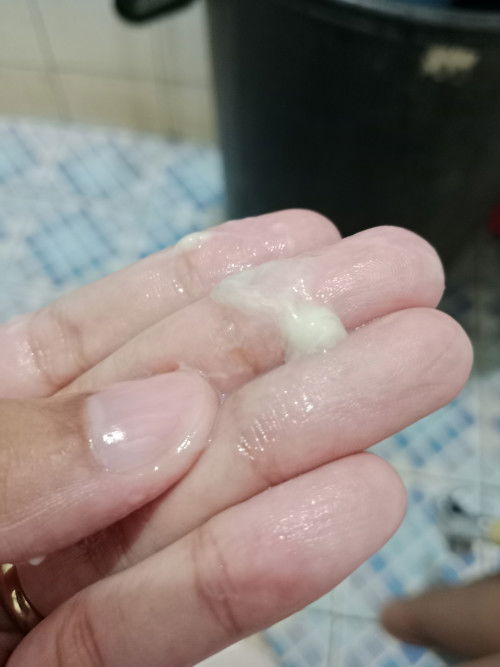 อีกนานมั้ยคะกว่าจะคลอด