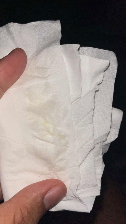 สอบถามค่ะแม่ๆ