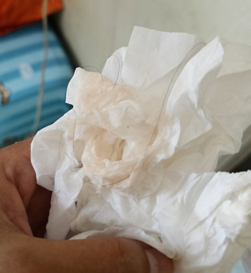 Kehamilan 38W2D keluar lendir darah, berlanjut rembes cairan berwarna pink