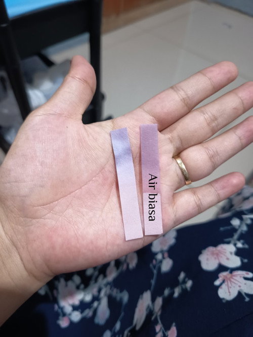 Air ketuban atau bukan?