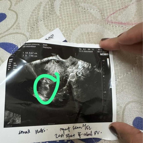 Keluar darah coklat