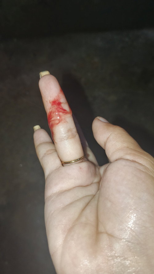 Masakit pus on kopo 11pm pato nag simula