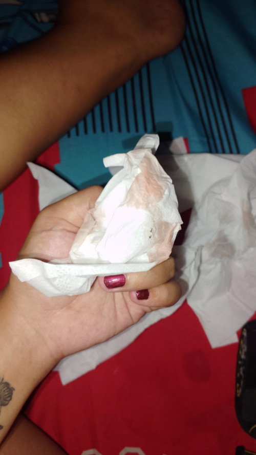 Dari pagi sakit bgt perut sampe pinggang terus keluar Kya gini