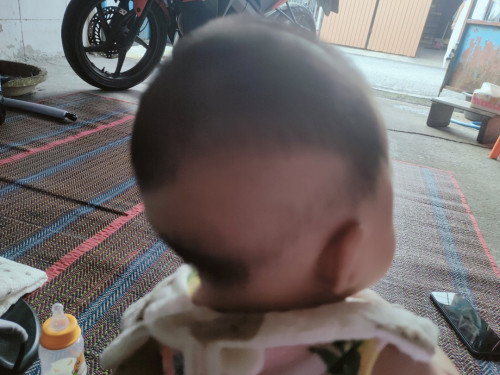 โกนผมไฟ ผมข้างหลังไม่ขึ้น