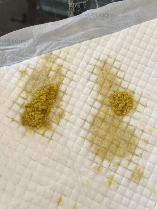 อึแบบนี้ปกติไหมคะ