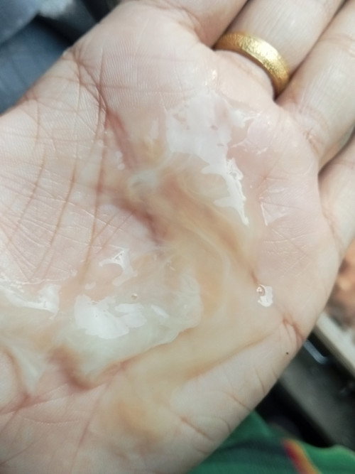 hpl 4 April , pembukaan udah 2 , udah ngeluarin lender coklat tapi darah merahnya dikit