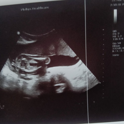 แม่ๆช่วยดูหน่อยว่าผู้หญิงหรือผู้ชาย