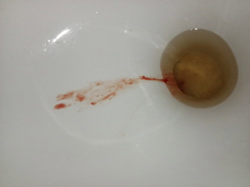 35weeks &4days  base sa ultrasound ko but sa last mens ko july 21 2025