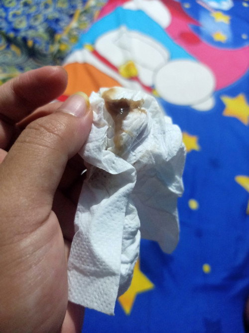 Maaf mau tanya di kehamilan 37 week 3 hari keluar lendir coklat apakah tanda² mau melahirkan bunda²?