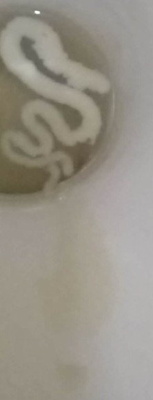 Ask lang po about sa white discharge. Mag 7mons preggy na po ako.