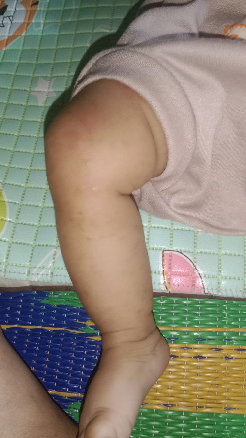 Masalah kulit bayi