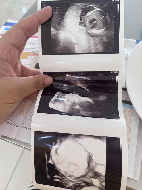 น้ำหนักตัวของลูก