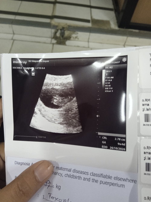Izin tanya Bun mohon arahannya