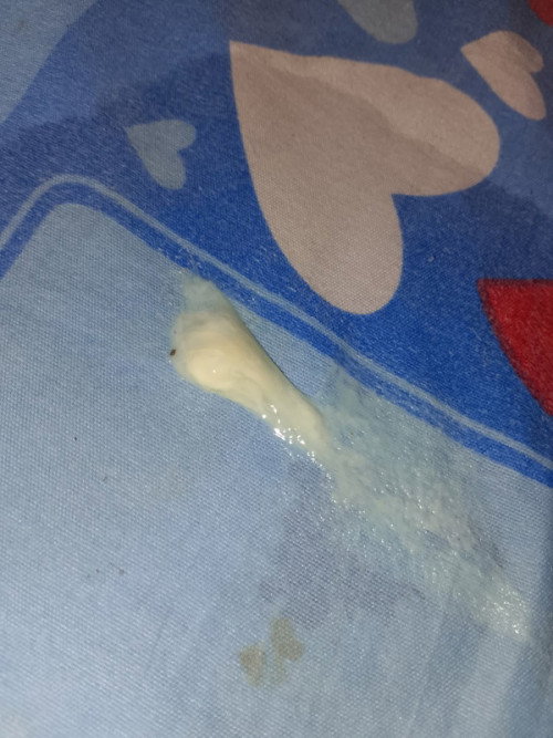 36+¹สัปดาห์ มีก้อนสีขุนๆใสๆออกมาตอนจามมีน้ำออกมาด้วย ไม่มีกลิ่น ลูกดิ้นน้อยลงปวดหลังมากๆๆ