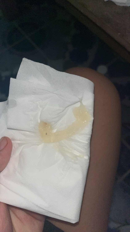 แม่ๆ39+5 มีแบบนี้คือใกล้รึยังคะ