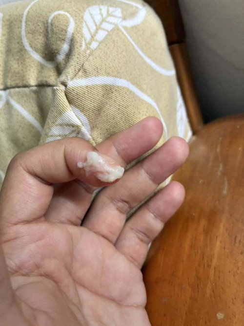 Discharge ke keputihan biasa?