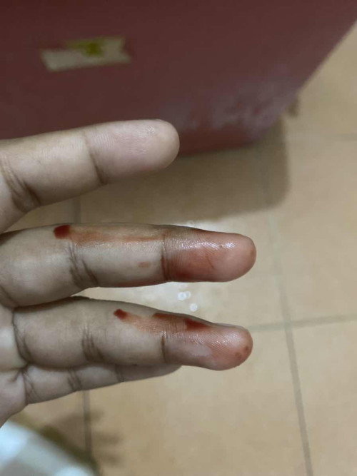 #สอบถามแม่ๆค่ะ