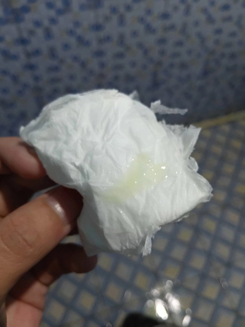 Kehamilan pertama di 38 weeks