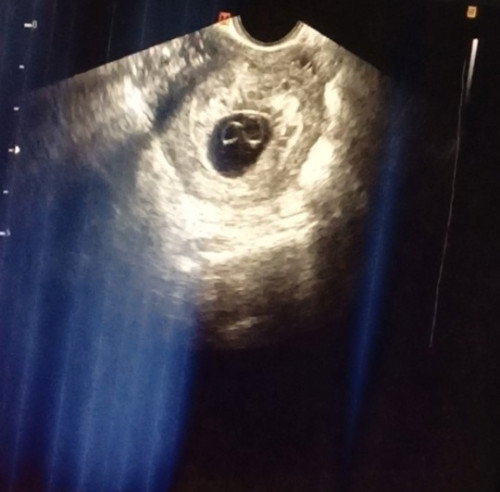 dapat po ba akong mabahala?