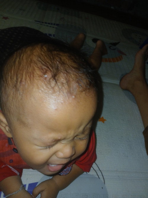 Bisula. Di kepala kecil kecil