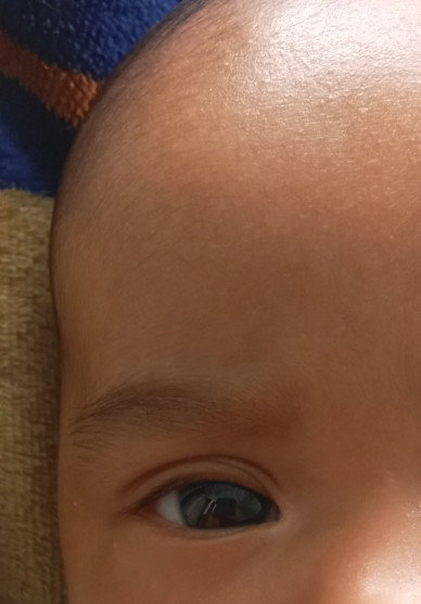 Ujung mata bayi putih
