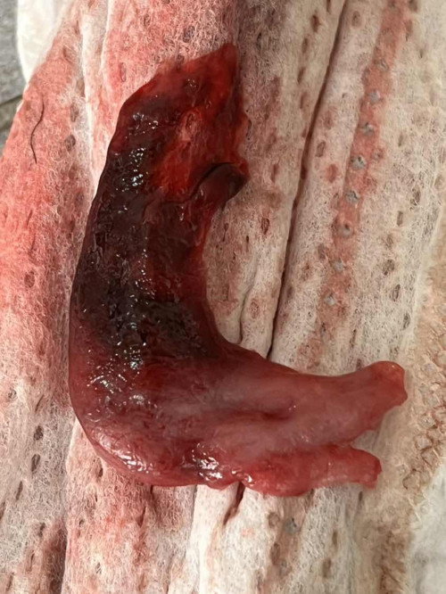 แบบนี้แท้งรึป่าวคะ😭😭