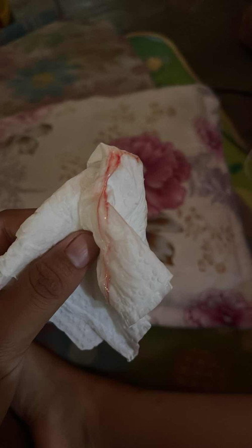 แบบนี้กี่วันคลอดคะ