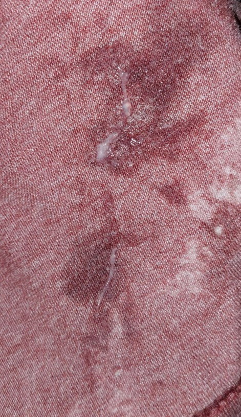 มูกหรือตกขาวคะ