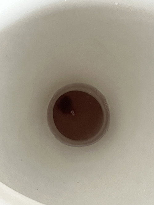 หลังแท้ง แบบนี้อันตรายมั้ย