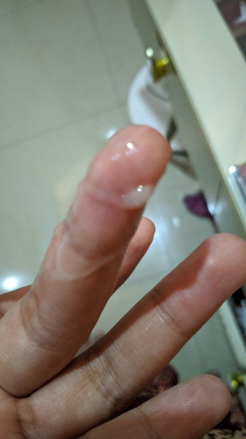 37 week kontraksi intens keluar kaya gitu bun