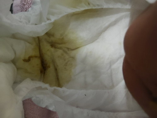 น้องแรกเกิด4วัน ขี้แบบนี้ทั้งวันแล้วค่ะวันนี้ ปกติมั้ยค่ะ