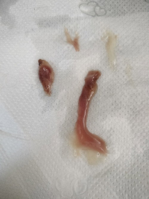 นี้คือสัญญาณว่าไกล้คลอดไหมคะ