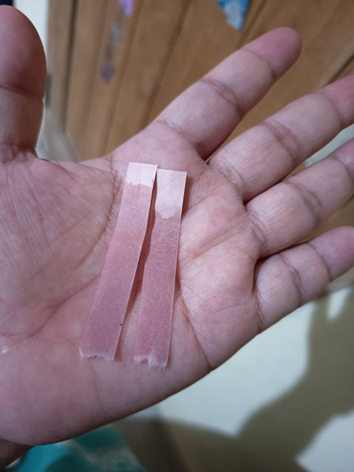 Warna air ketuban di kertas lakmus?