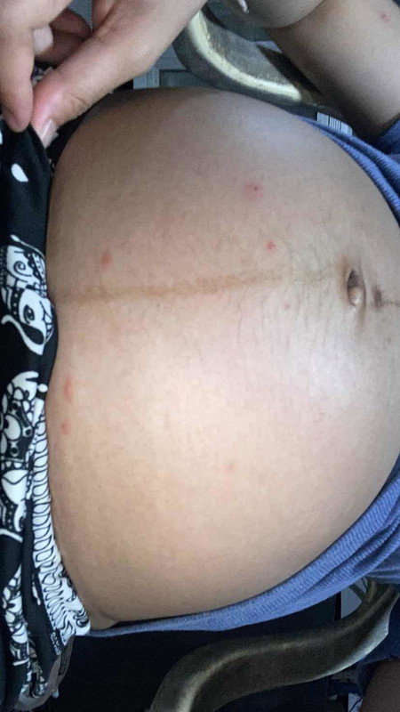 ท้องแรก 32วีค