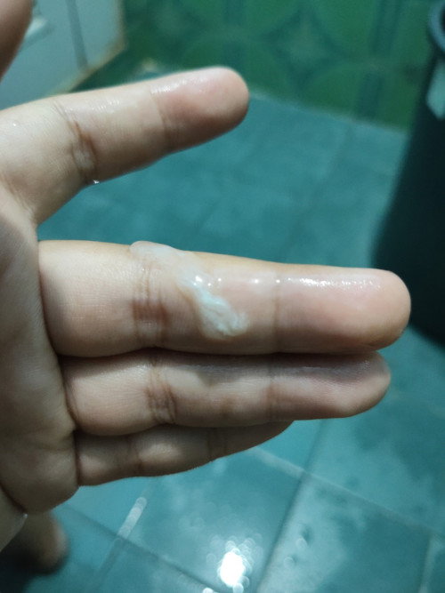 เป็นตกขาวแบบนี้อันตรายมั้ยคะ