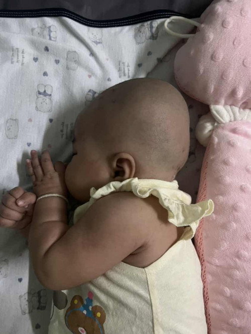 แบบนี้ถือว่าลูกหัวแบนไหมคะ