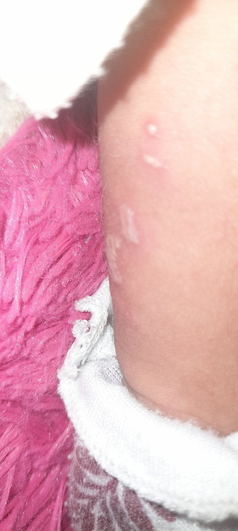 Cara nyembuhin ini gimna yahh bun