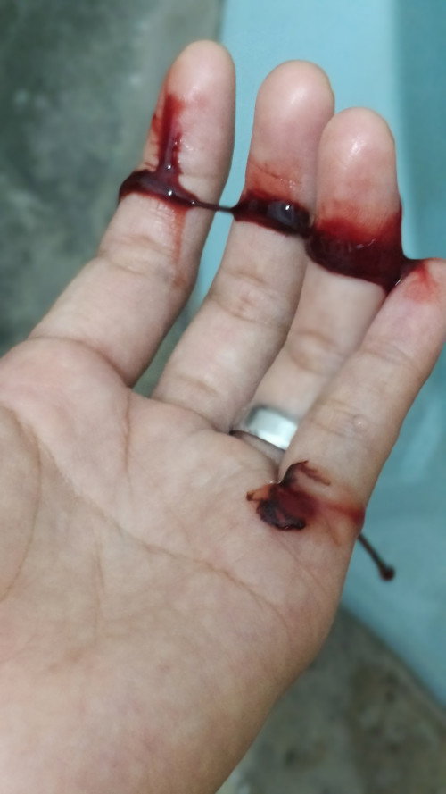 Keluar darah lendir saat positif