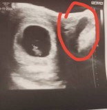 Confuse sebelah kantung tu apa