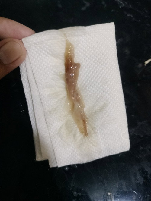 38+2 มีมูกออก